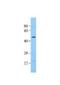 Pannexin 1 antibody, NBP1-59672, Novus Biologicals, Western Blot image 