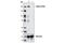 TSC Complex Subunit 2 antibody, 4308P, Cell Signaling Technology, Western Blot image 