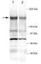 Tankyrase-1 antibody, GTX30143, GeneTex, Western Blot image 