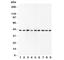 SRY-Box 7 antibody, R31409, NSJ Bioreagents, Western Blot image 