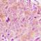 Phospholipase C Gamma 2 antibody, orb256753, Biorbyt, Immunohistochemistry paraffin image 