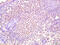 Sp7 Transcription Factor antibody, GTX02884, GeneTex, Immunohistochemistry paraffin image 