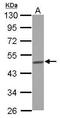 Branched Chain Keto Acid Dehydrogenase E1 Subunit Alpha antibody, GTX111382, GeneTex, Western Blot image 