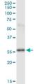 Phosphoserine Phosphatase antibody, H00005723-M01, Novus Biologicals, Western Blot image 