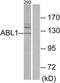 ABL Proto-Oncogene 1, Non-Receptor Tyrosine Kinase antibody, TA312758, Origene, Western Blot image 