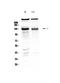 Bone Morphogenetic Protein Receptor Type 2 antibody, A00324-1, Boster Biological Technology, Western Blot image 