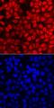 Forkhead Box P1 antibody, MAB4534, R&D Systems, Immunofluorescence image 