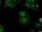 Betaine--Homocysteine S-Methyltransferase antibody, GTX84827, GeneTex, Immunofluorescence image 