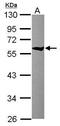 Chaperonin Containing TCP1 Subunit 8 antibody, GTX115466, GeneTex, Western Blot image 