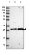 Centromere Protein Q antibody, HPA046634, Atlas Antibodies, Western Blot image 