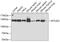 Elongation Factor Tu GTP Binding Domain Containing 2 antibody, GTX55602, GeneTex, Western Blot image 