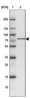 ATP Binding Cassette Subfamily F Member 2 antibody, PA5-54517, Invitrogen Antibodies, Western Blot image 