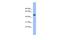 Serine Peptidase Inhibitor, Kunitz Type 1 antibody, A04685-1, Boster Biological Technology, Western Blot image 