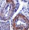 Thyroid Hormone Receptor Interactor 6 antibody, LS-C160218, Lifespan Biosciences, Immunohistochemistry paraffin image 