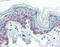 Keratin 5 antibody, 49-058, ProSci, Immunohistochemistry paraffin image 