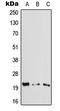 Cytoglobin antibody, LS-C353616, Lifespan Biosciences, Western Blot image 