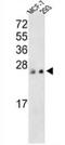 Protein Tyrosine Phosphatase 4A3 antibody, AP15253PU-N, Origene, Western Blot image 