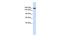 Laminin Subunit Gamma 1 antibody, GTX44865, GeneTex, Western Blot image 