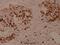 Potassium Voltage-Gated Channel Subfamily D Member 1 antibody, A11599, Boster Biological Technology, Immunohistochemistry paraffin image 