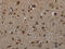 GLI Pathogenesis Related 1 antibody, CSB-PA640140, Cusabio, Immunohistochemistry frozen image 