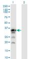 Aprataxin antibody, H00054840-M02, Novus Biologicals, Western Blot image 