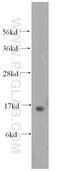 Retinol Binding Protein 5 antibody, 11843-1-AP, Proteintech Group, Western Blot image 