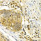 Cyclin Dependent Kinase 7 antibody, A1694, ABclonal Technology, Immunohistochemistry paraffin image 