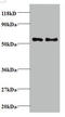 Tax1 Binding Protein 3 antibody, A51777-100, Epigentek, Western Blot image 