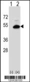 Sphingomyelin Synthase 2 antibody, 64-088, ProSci, Western Blot image 