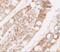 Lipin 1 antibody, A02467, Boster Biological Technology, Immunohistochemistry paraffin image 