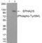 EPH Receptor A2 antibody, PA5-37812, Invitrogen Antibodies, Western Blot image 