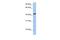 IGF Like Family Receptor 1 antibody, PA5-43436, Invitrogen Antibodies, Western Blot image 