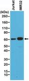 SMAD Family Member 4 antibody, NBP2-61587, Novus Biologicals, Western Blot image 