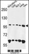 Ankyrin Repeat And FYVE Domain Containing 1 antibody, 61-631, ProSci, Western Blot image 