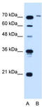 GST antibody, TA334613, Origene, Western Blot image 