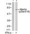 Neurofibromin 2 antibody, GTX50291, GeneTex, Western Blot image 