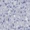 AKAP4 antibody, NBP1-89165, Novus Biologicals, Immunohistochemistry paraffin image 