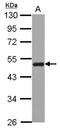 Sorting Nexin 5 antibody, NBP2-20448, Novus Biologicals, Western Blot image 