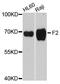 Coagulation Factor II, Thrombin antibody, abx126904, Abbexa, Western Blot image 