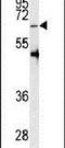 Protein Arginine Methyltransferase 5 antibody, PA5-11120, Invitrogen Antibodies, Western Blot image 