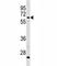 Complement C8 Beta Chain antibody, F47544-0.4ML, NSJ Bioreagents, Western Blot image 