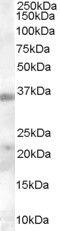 Hepatitis A Virus Cellular Receptor 2 antibody, PA5-18470, Invitrogen Antibodies, Western Blot image 