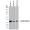 Carbonic Anhydrase 1 antibody, MAB2180, R&D Systems, Western Blot image 