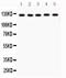 MutS Homolog 3 antibody, PB9285, Boster Biological Technology, Western Blot image 