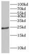 Guanylate Cyclase Activator 1A antibody, FNab03378, FineTest, Western Blot image 