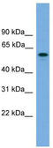 MTOR Associated Protein, Eak-7 Homolog antibody, TA344745, Origene, Western Blot image 