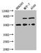 Transcobalamin 2 antibody, A63548-100, Epigentek, Western Blot image 