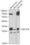 Methyltransferase Like 7B antibody, 22-777, ProSci, Western Blot image 