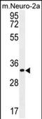 Zinc Finger CCCH-Type Containing 8 antibody, PA5-48207, Invitrogen Antibodies, Western Blot image 