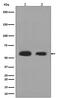 Calreticulin antibody, M00894, Boster Biological Technology, Western Blot image 